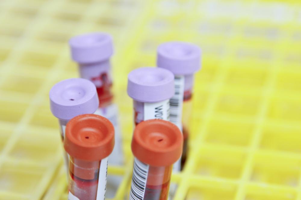 Foto di National Cancer Institute